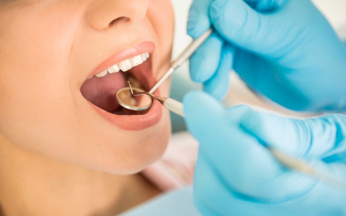 Teeth Implants – Types and operations