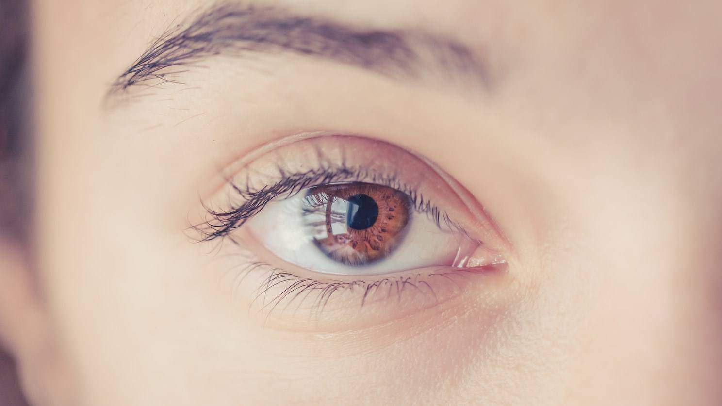 Eye Bags