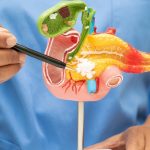 Gastrointestinal Surgeries