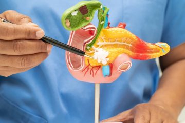 Gastrointestinal Surgeries